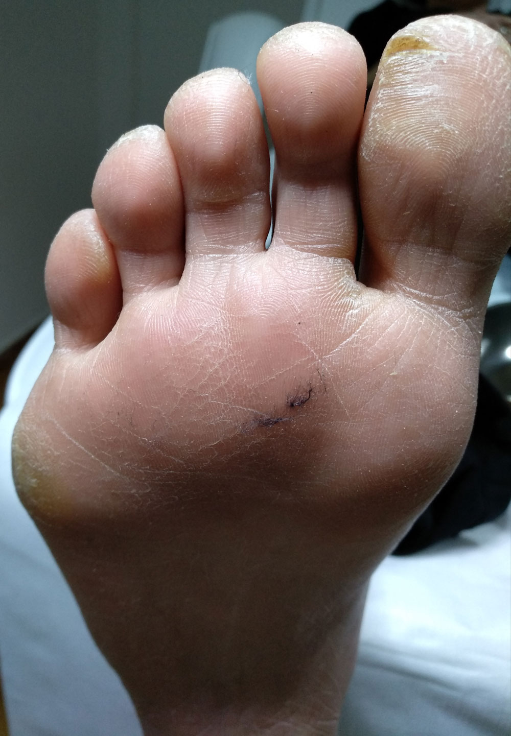 Before image