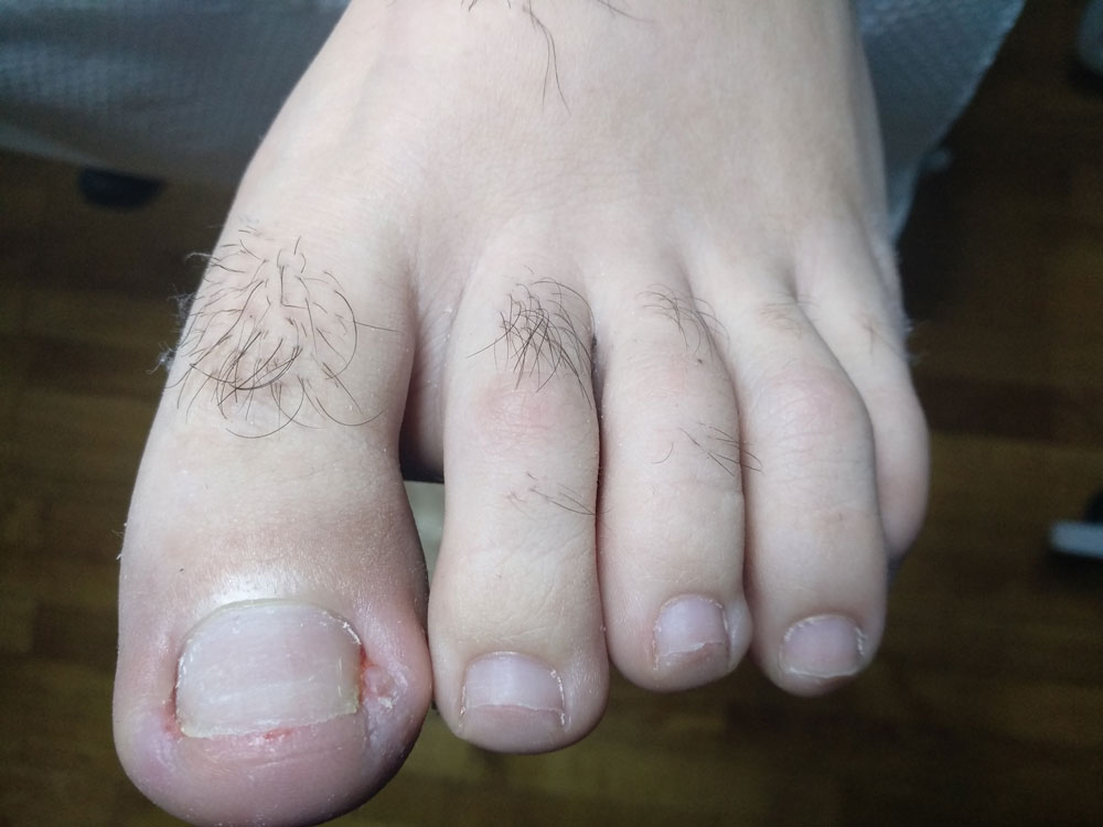 Before image