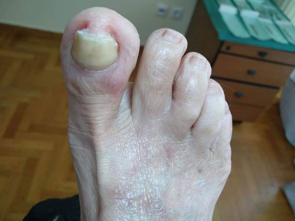 Before image