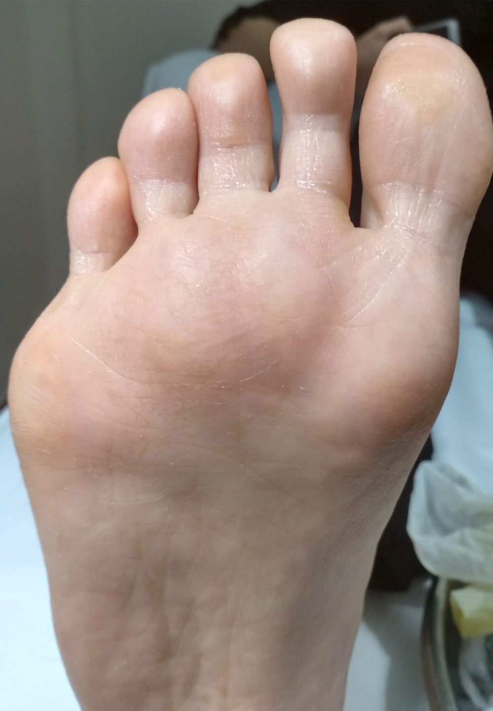 After image