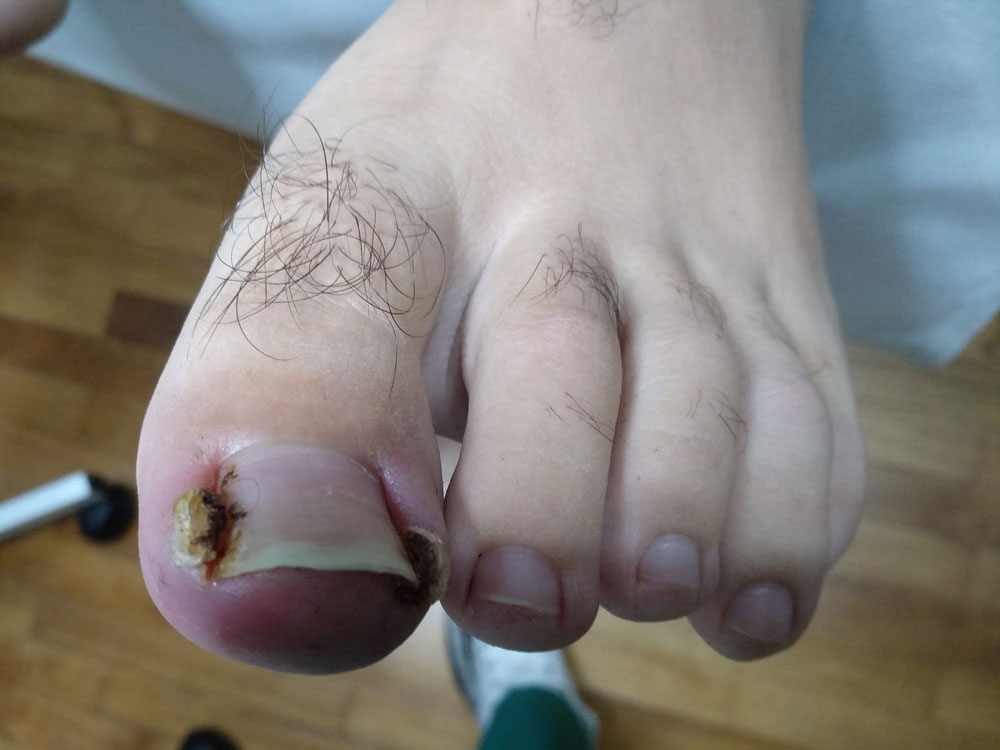 After image