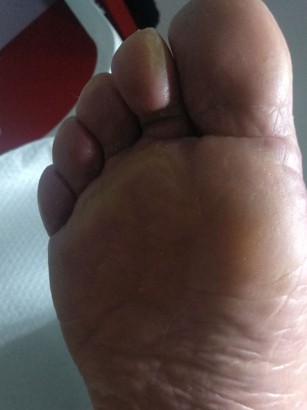 After image