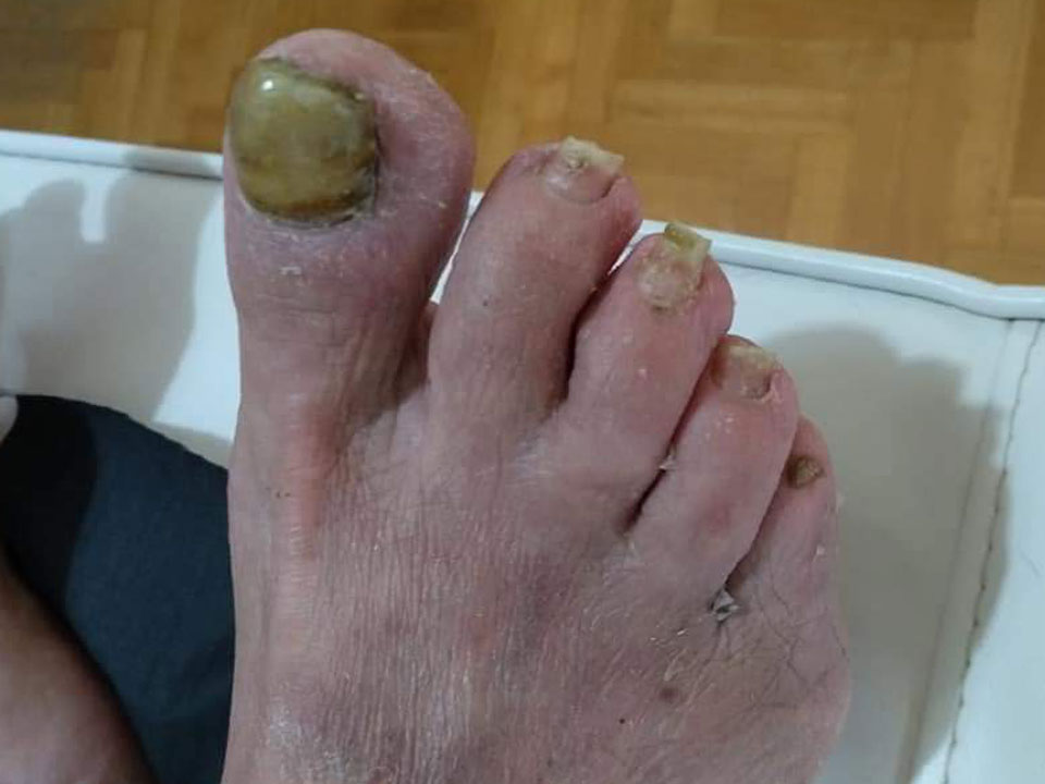 After image