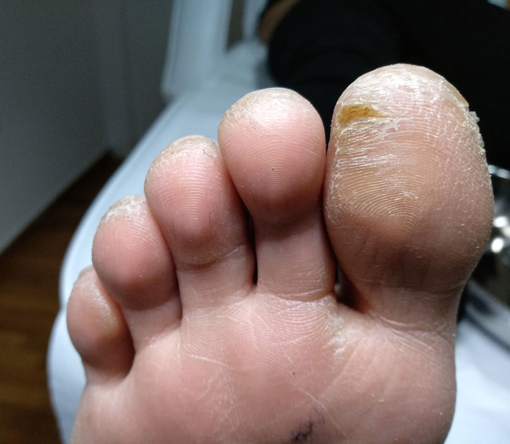 Before image