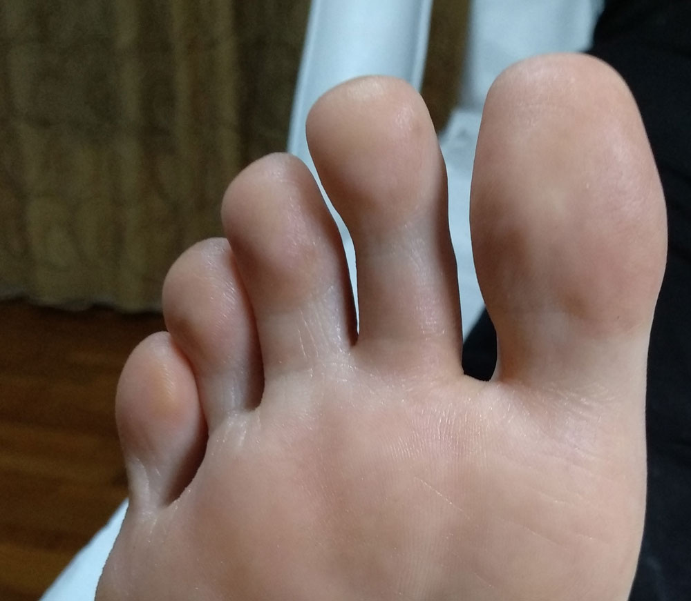 After image