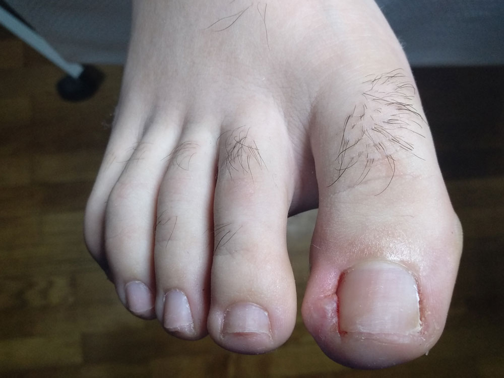 After image