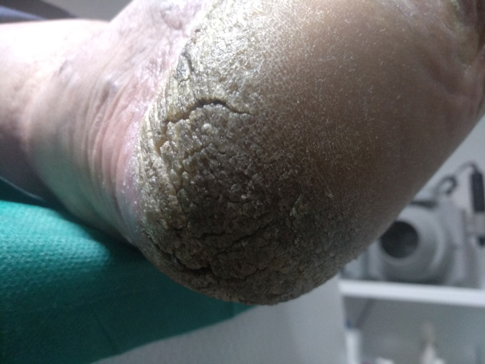 After image