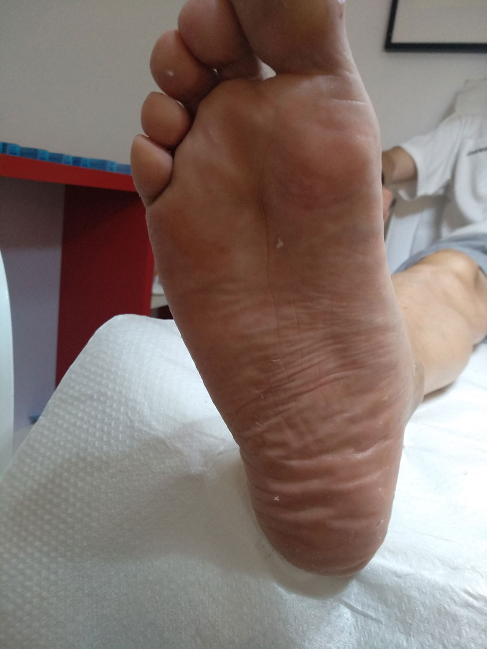 After image